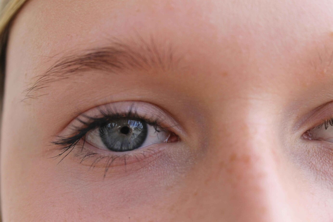 Zit mijn lens achter mijn oog?