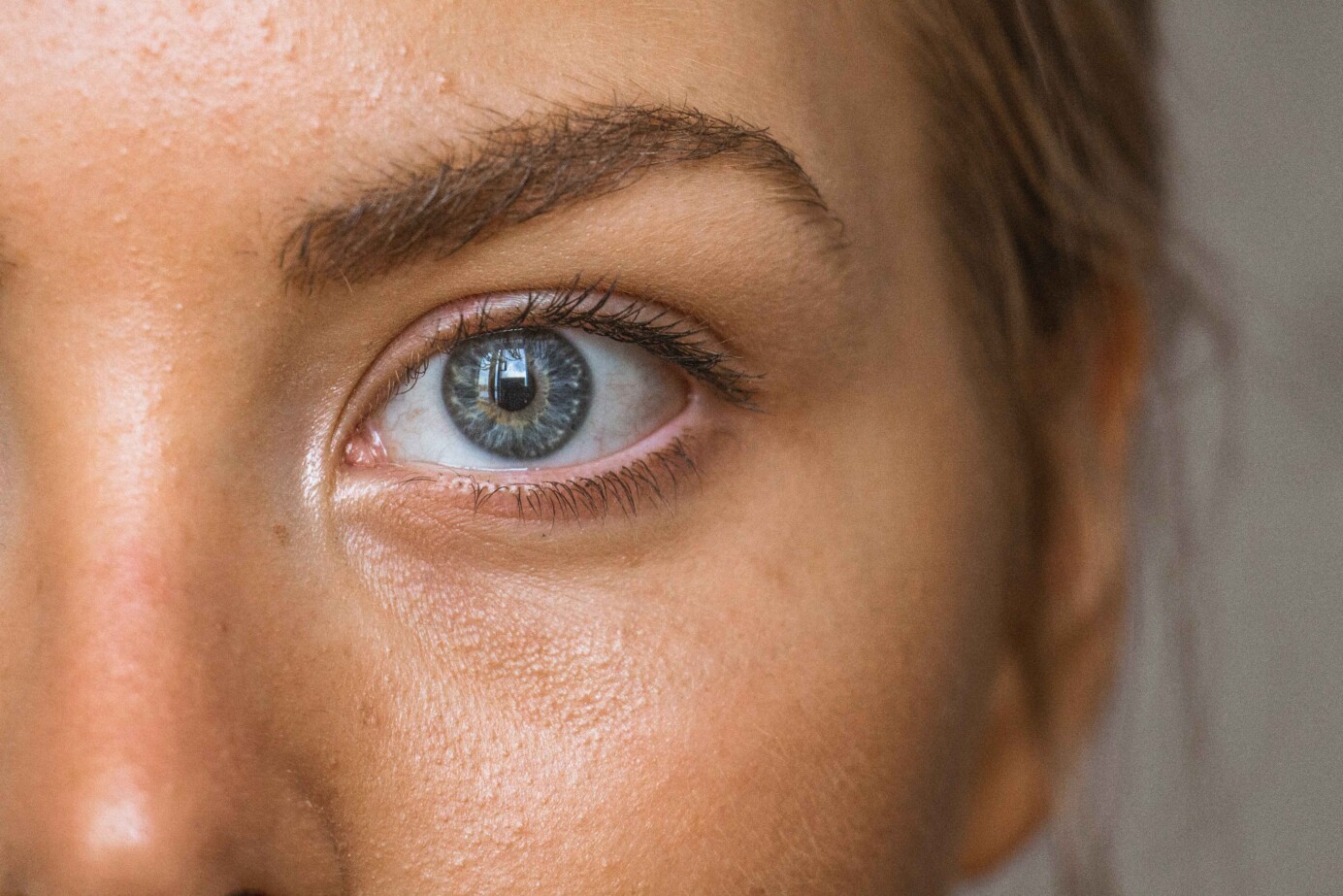 Wat is opticusneuritis?